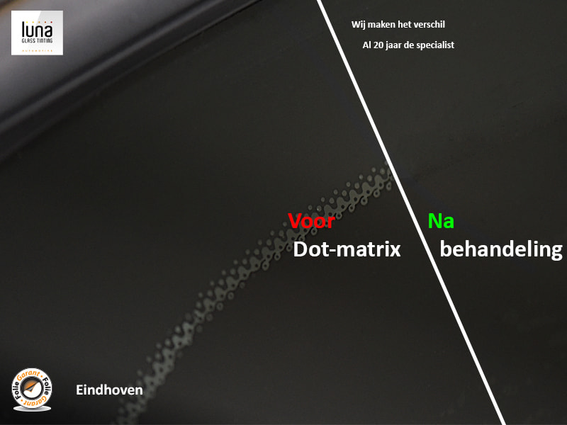 Voor en na dot matrix behandeling